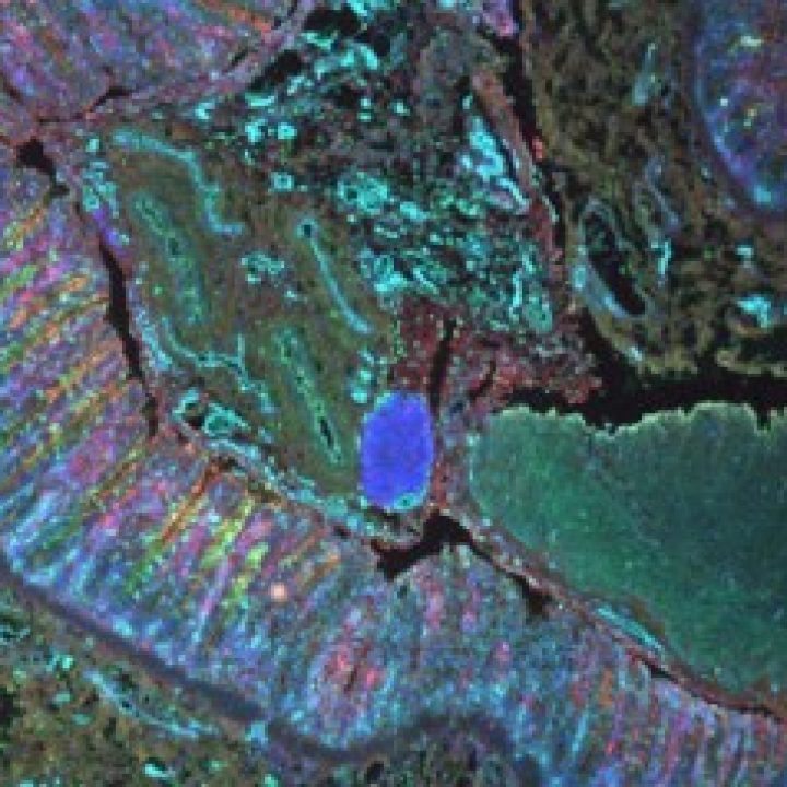 forschung - chirugie - holland-cunz
